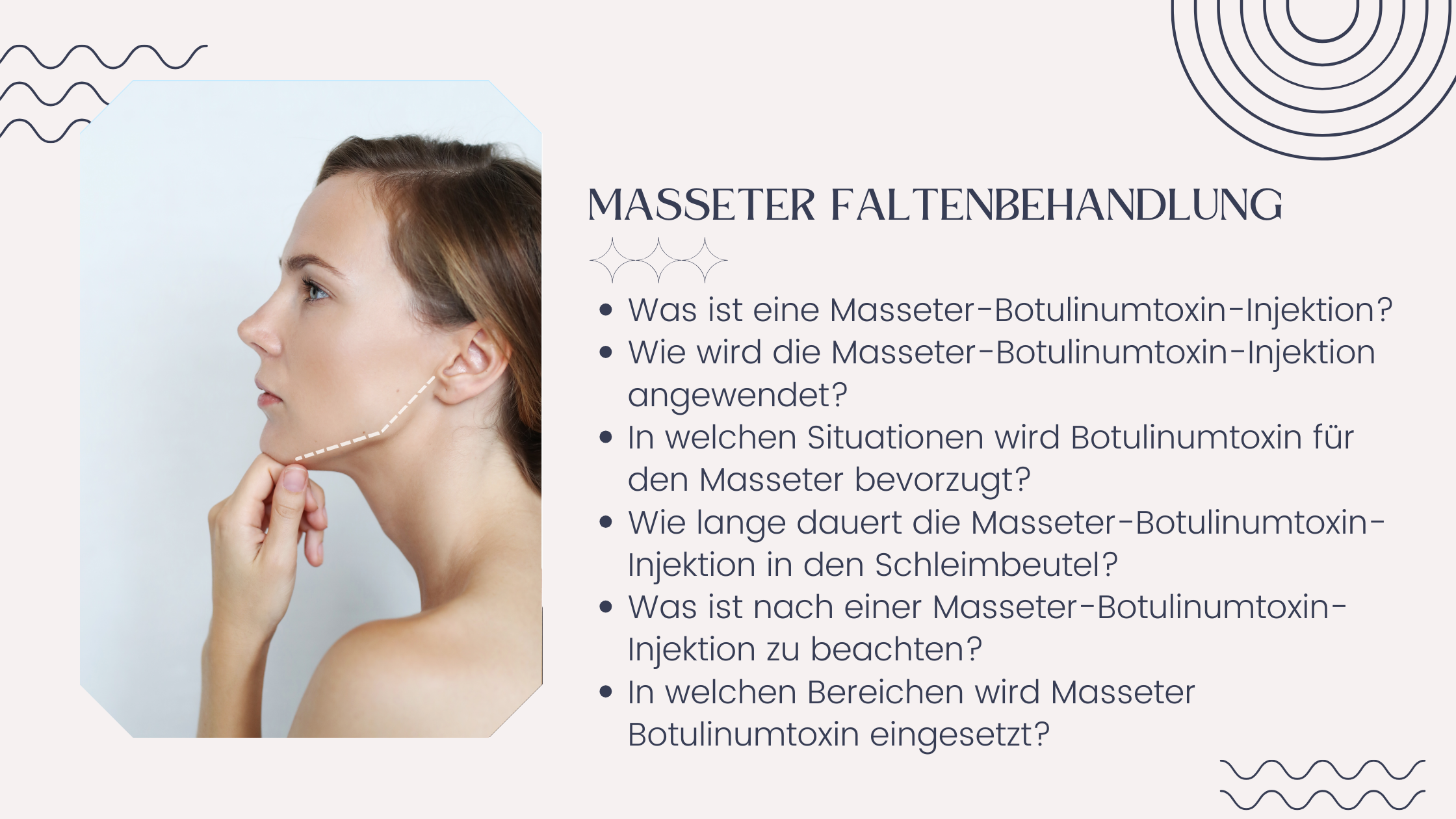 Masseter Faltenbehandlung